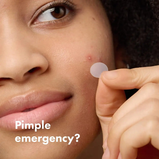 Mighty Patch Original – Acne Pimple Patches by Hero