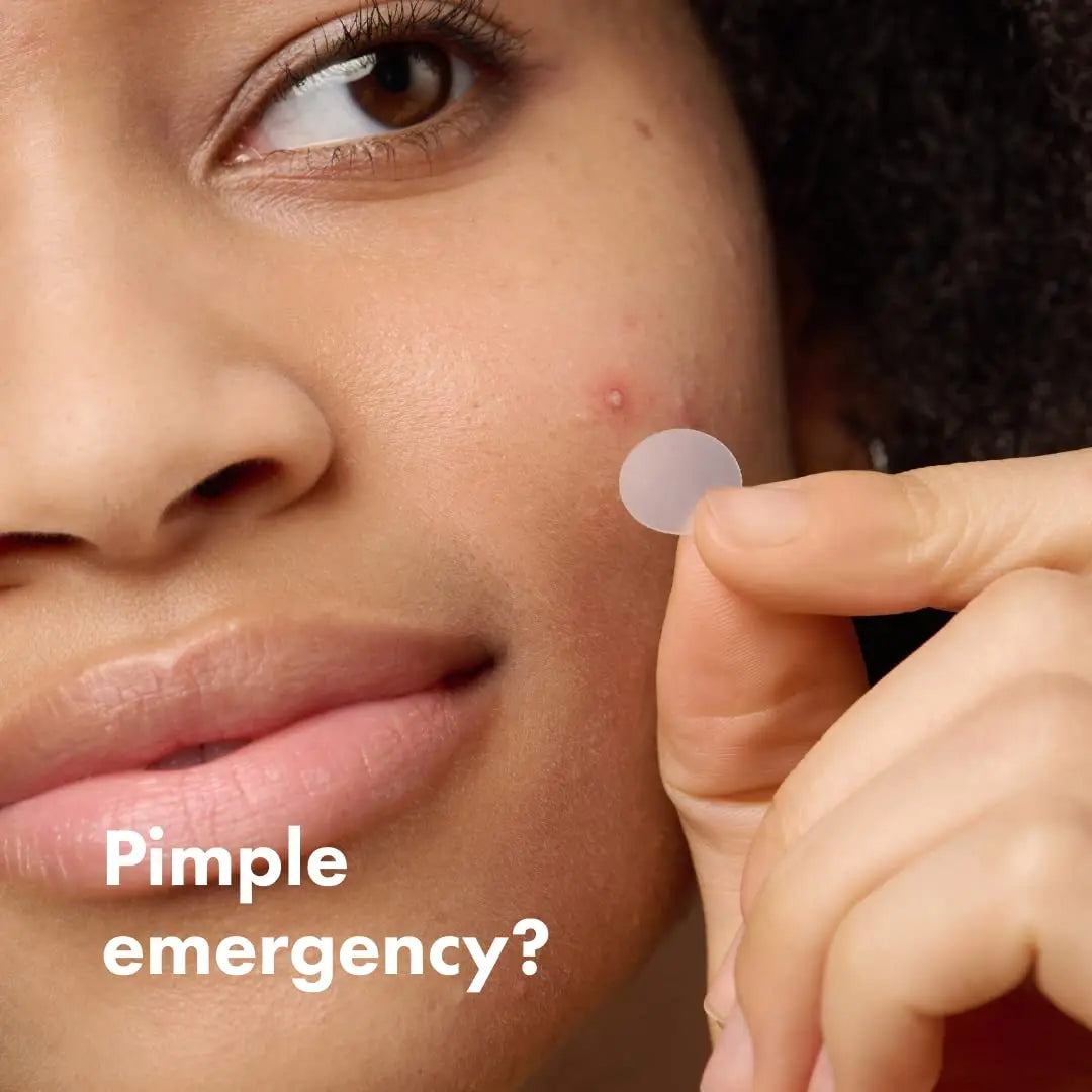Mighty Patch Original – Acne Pimple Patches by Hero