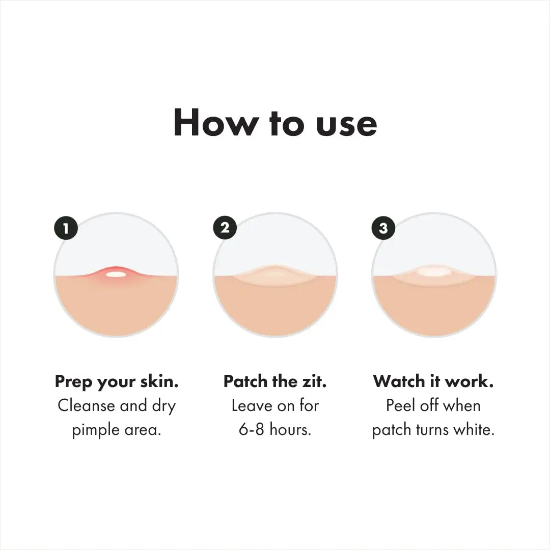Mighty Patch Original – Acne Pimple Patches by Hero